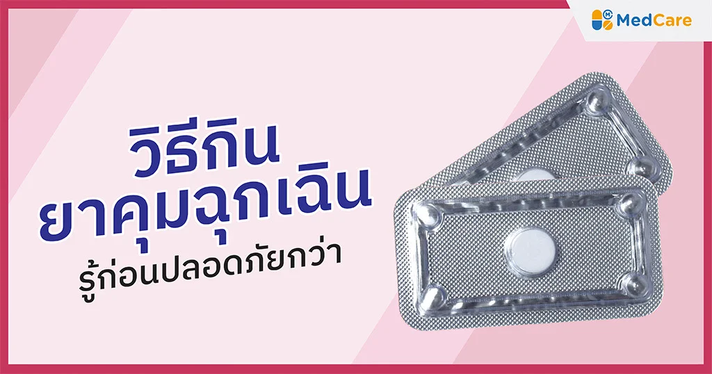 วิธีกินยาคุมฉุกเฉินอย่างถูกต้อง
