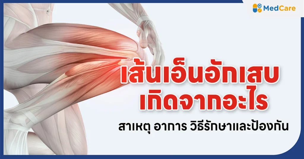 เส้นเอ็นอักเสบ